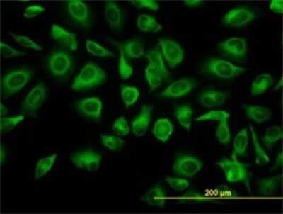 Immunocytochemistry/ Immunofluorescence: TUBA6 Antibody (S11) [H00084790-M04]