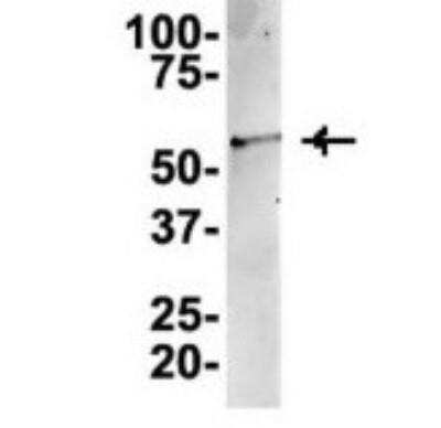 Western Blot: TUBA6 Antibody [NBP1-79850]