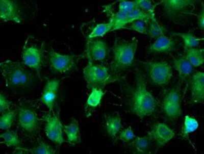 Immunocytochemistry/ Immunofluorescence: TUBAL3 Antibody (OTI4C5) [NBP2-01476]