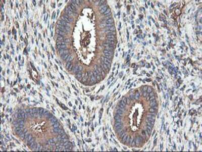 Immunohistochemistry-Paraffin: TUBAL3 Antibody (OTI4C5) [NBP2-01476]