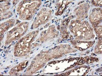 Immunohistochemistry-Paraffin: TUBAL3 Antibody (OTI4C5) [NBP2-01476]