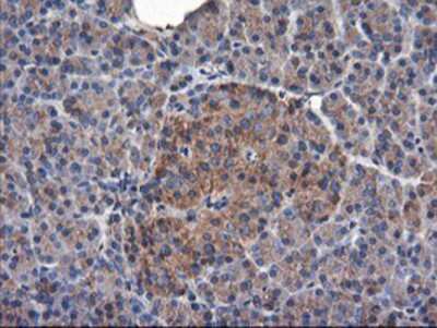 Immunohistochemistry-Paraffin: TUBAL3 Antibody (OTI4C5) [NBP2-01476]