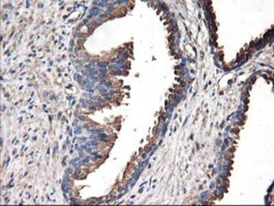 Immunohistochemistry-Paraffin: TUBAL3 Antibody (OTI4C5) [NBP2-01476]