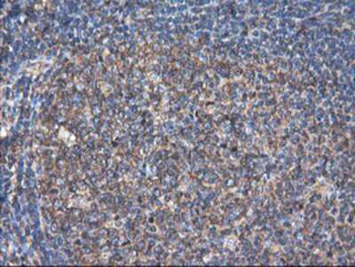 Immunohistochemistry-Paraffin: TUBAL3 Antibody (OTI4C5) [NBP2-01476]
