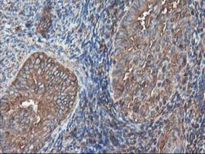 Immunohistochemistry: TUBAL3 Antibody (OTI4C5) - Azide and BSA Free [NBP2-74696]