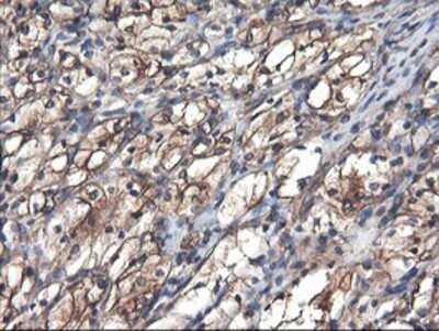 Immunohistochemistry: TUBAL3 Antibody (OTI4C5) - Azide and BSA Free [NBP2-74696]