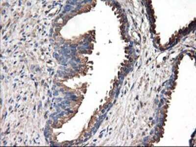 Immunohistochemistry: TUBAL3 Antibody (OTI4C5) - Azide and BSA Free [NBP2-74696]