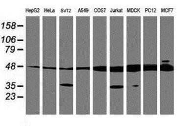 Western Blot: TUBAL3 Antibody (OTI4C5)Azide and BSA Free [NBP2-74696]