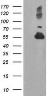Western Blot: TUBAL3 Antibody (OTI4C5)Azide and BSA Free [NBP2-74696]
