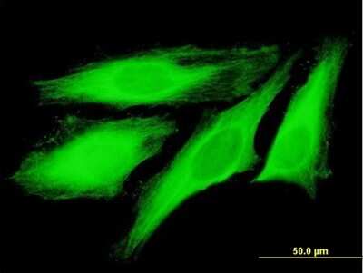 Immunocytochemistry/ Immunofluorescence: TUBB4Q Antibody [H00056604-B01P]