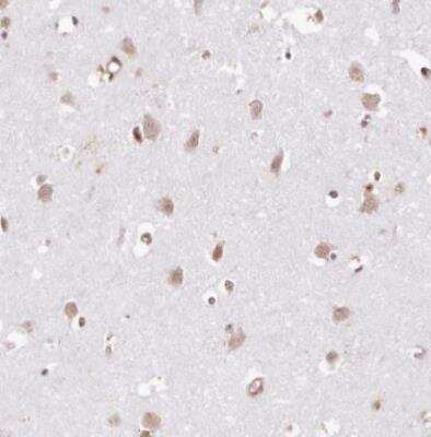 Immunohistochemistry-Paraffin: TUBGCP2 Antibody [NBP1-81841]