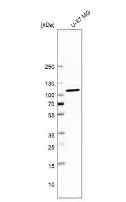 Western Blot: TUBGCP2 Antibody [NBP1-81841]