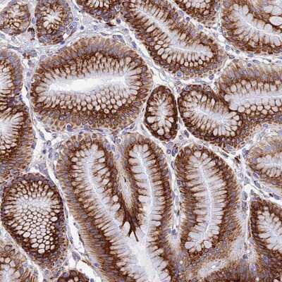 Immunohistochemistry-Paraffin: TUBGCP6 Antibody [NBP1-92548]