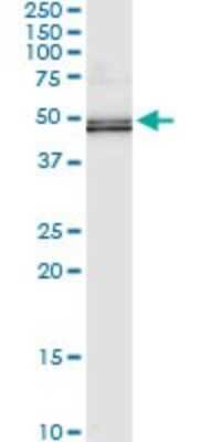 Immunoprecipitation: TUFM Antibody (1A2) [H00007284-M03]
