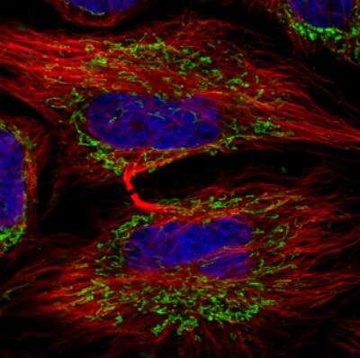 Immunocytochemistry/ Immunofluorescence: TUFM Antibody (CL2242) [NBP2-36751]