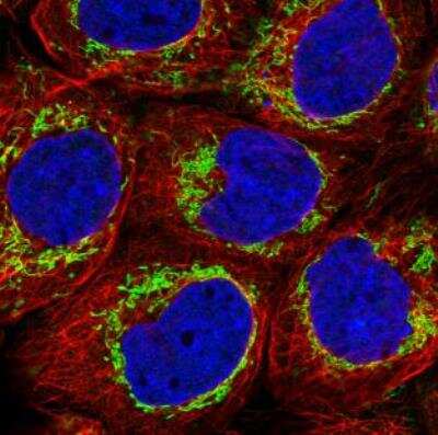 Immunocytochemistry/ Immunofluorescence: TUFM Antibody (CL2242) [NBP2-36751]