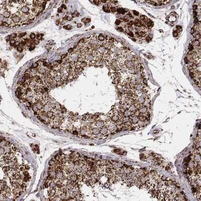 Immunohistochemistry-Paraffin: TUFM Antibody (CL2242) [NBP2-36751]