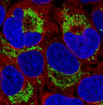 Immunocytochemistry/ Immunofluorescence: TUFM Antibody (CL2243) [NBP2-36752]