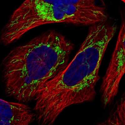 Immunocytochemistry/ Immunofluorescence: TUFM Antibody [NBP1-84889]