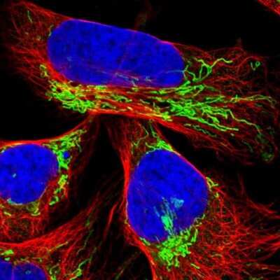 Immunocytochemistry/ Immunofluorescence: TUFM Antibody [NBP1-84890]