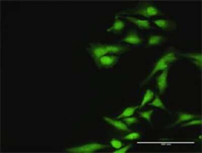Immunocytochemistry/ Immunofluorescence: TUG Antibody [H00079058-D01P]