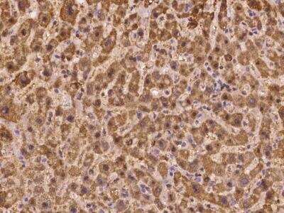 Immunohistochemistry-Paraffin: TUG Antibody [NBP3-12632]
