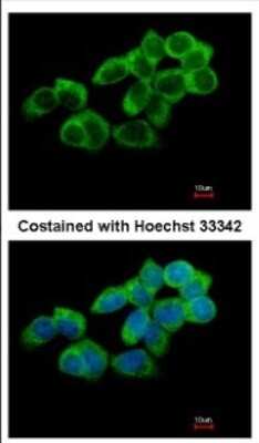 Immunocytochemistry/ Immunofluorescence: TULA/STS-2 Antibody [NBP2-20763]