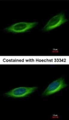 Immunocytochemistry/ Immunofluorescence: TULP1 Antibody [NBP1-31401]