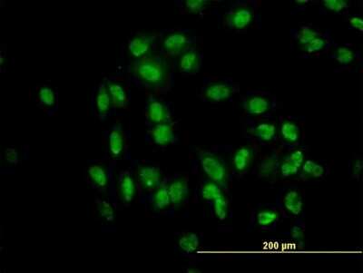 Immunocytochemistry/ Immunofluorescence: TULP2 Antibody (2B5) [H00007288-M03]