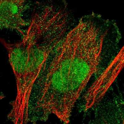 Immunocytochemistry/ Immunofluorescence: TULP3 Antibody [NBP2-55375]