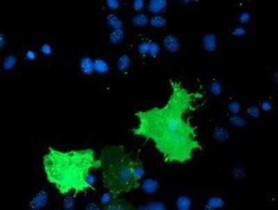 Immunocytochemistry/ Immunofluorescence: TULP3 Antibody (OTI7B8) - Azide and BSA Free [NBP2-74721]