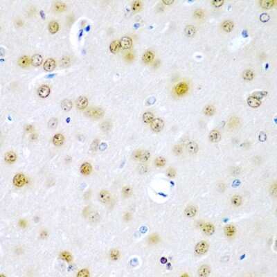 Immunohistochemistry-Paraffin: TUSC2 Antibody - BSA Free [NBP3-04411]