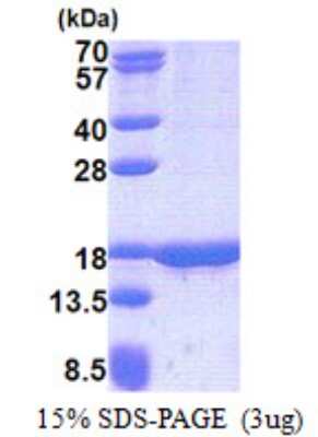 SDS-PAGE: Recombinant Human TUSC2 His Protein [NBP2-22910]