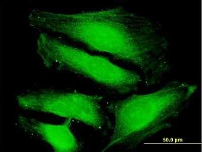 Immunocytochemistry/ Immunofluorescence: TUSC4 Antibody [H00010641-B01P]