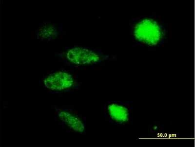 Immunocytochemistry/ Immunofluorescence: TUSC4 Antibody [H00010641-B02P]