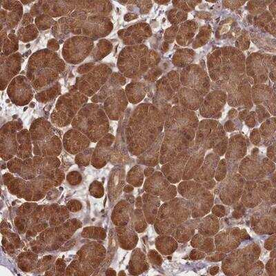 Immunohistochemistry-Paraffin: TUSC4 Antibody [NBP1-82537]