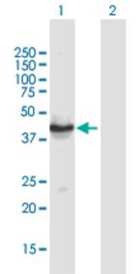 Western Blot: TUSC4 Antibody [H00010641-B01P]