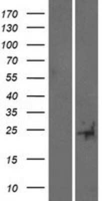 Western Blot: TUSC5 Overexpression Lysate [NBP2-05164]