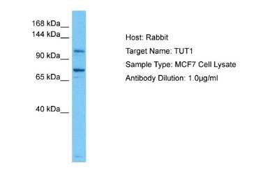 Western Blot: TUT1 Antibody [NBP2-86028]