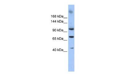 Western Blot: TUT1 Antibody [NBP2-86028]