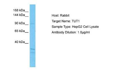 Western Blot: TUT1 Antibody [NBP2-86030]