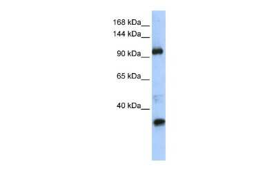Western Blot: TUT1 Antibody [NBP2-86030]