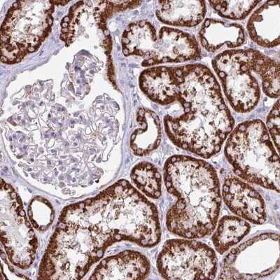 Immunohistochemistry-Paraffin: TVP23A Antibody [NBP2-32556]