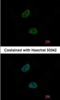 Immunocytochemistry/ Immunofluorescence: TWA1 Antibody [NBP1-32596]