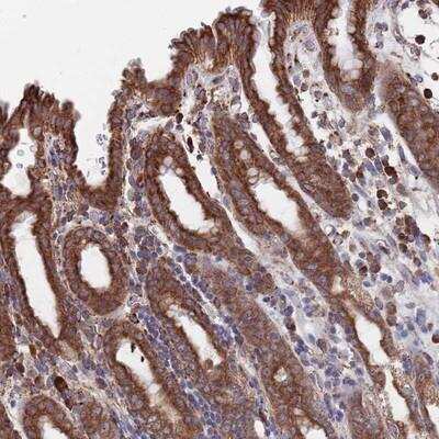 Immunohistochemistry-Paraffin: TWA1 Antibody [NBP2-14397]