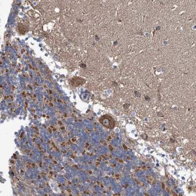 Immunohistochemistry-Paraffin: TWISTNB Antibody [NBP1-89449]