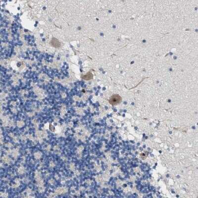 Immunohistochemistry-Paraffin: TWISTNB Antibody [NBP1-89454]