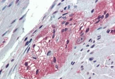 Immunohistochemistry-Paraffin: TXLNB Antibody [NBP3-14510]