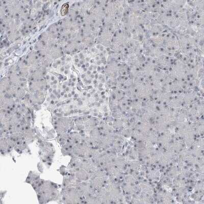 Immunohistochemistry-Paraffin: TXLNB Antibody [NBP1-91161]