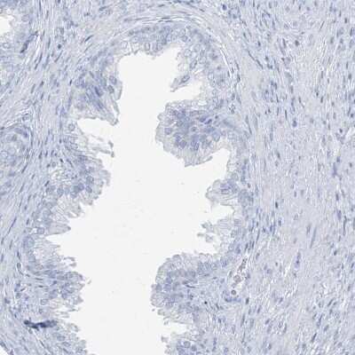 Immunohistochemistry-Paraffin: TXLNB Antibody [NBP2-33926]